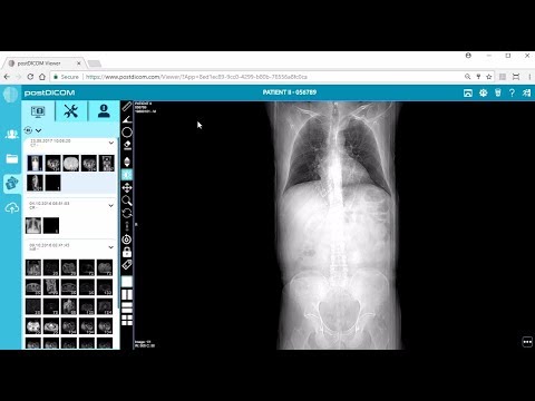 free dicom viewer radiology